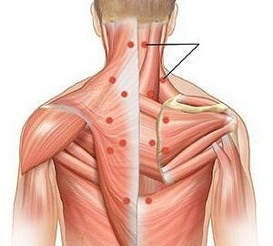 a miositis como causa de dores nas costas