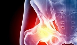 razóns para o desenvolvemento da artrose da cadeira