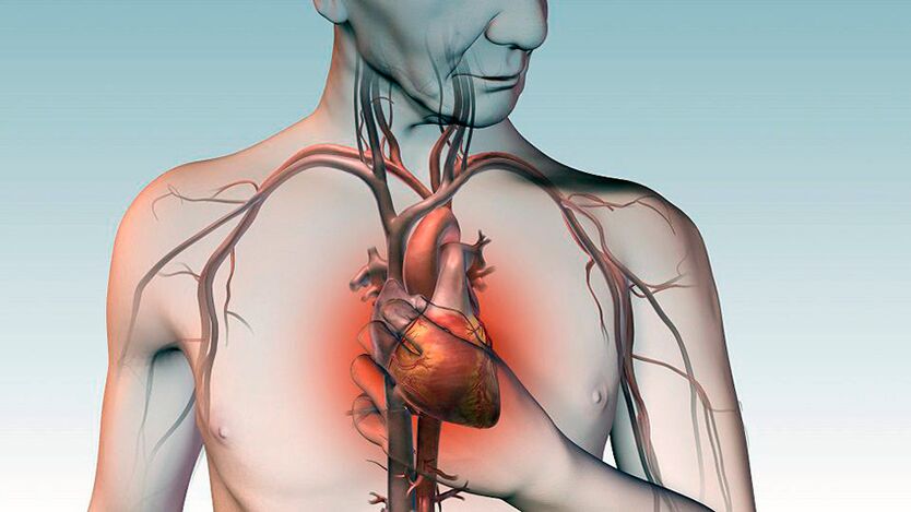 Dor baixo a escápula e dor presionante detrás do esterno con enfermidades cardíacas