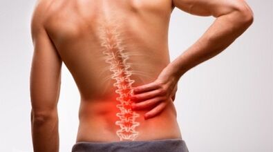 Signos e síntomas da osteocondrose da columna lumbar