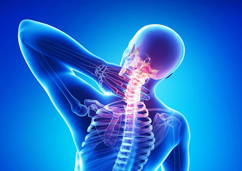 Osteocondrose do pescozo