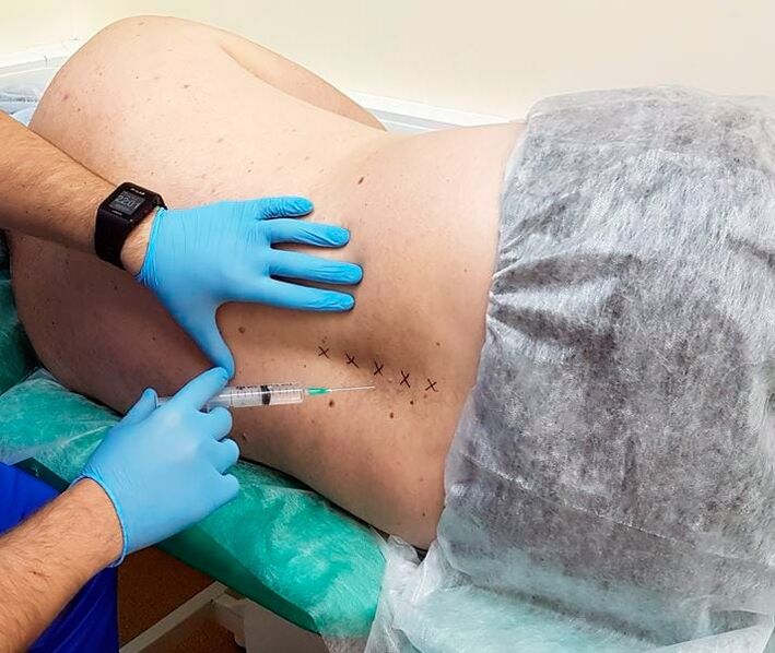 bloqueos medicinais para as costas